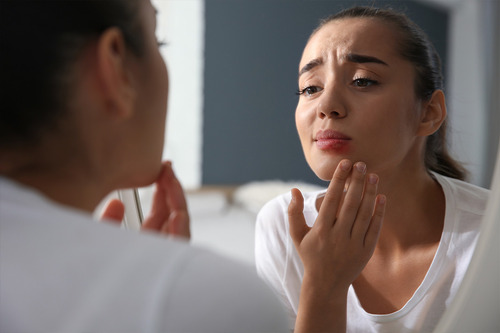 Symptoms of Cold Sores