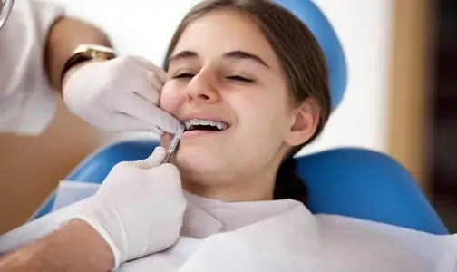 Why Are Retainers Necessary After Braces?